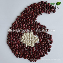 2015 New Crop LSKB Pinto Bean Purple Kidney Bean